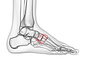 Medial cuneiform bone, illustration