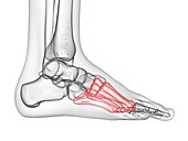 Metatarsal bone, illustration