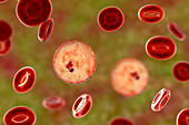 Plasmodium malariae inside red blood cell, illustration