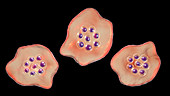Plasmodium ovale inside red blood cell