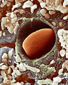 Heart capillary, SEM