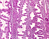 Endometrial glands in secretory phase,light micrograph