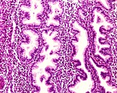 Endometrial glands in secretory phase,light micrograph