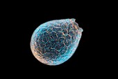 Shelled amoeba, light micrograph