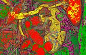 Abdominal organs,coloured CT scan