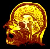 Human head and brain,sagittal MRI scan