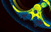 Spinal vertebra,3D CT scan
