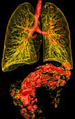 Gas in the lungs and intestines,3D CT scans