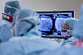 Spinal surgeons conferring during an operation