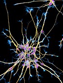 Neurons from stem cells,fluorescence light micrograph