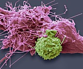 Natural killer cell and cancer cell,SEM