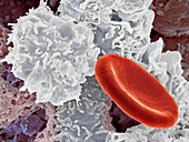 Tissue macrophage and red blood cell,SEM