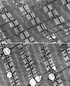 Muscle fibres before and after a spaceflight,TEM