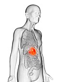 Illustration of an elderly man's stomach