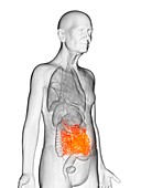 Illustration of an elderly man's small intestine