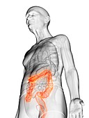 Illustration of an elderly man's colon