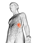 Illustration of an elderly man's spleen