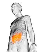 Illustration of an elderly man's small intestine