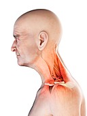 Illustration of an old man's neck muscles