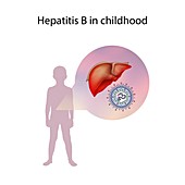 Hepatitis B in childhood,illustration