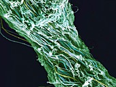 Human connective tissue, SEM