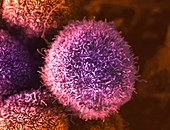 Pancreatic cancer cells, SEM