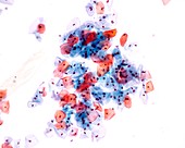 Vaginal smear, light micrograph