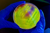 Clostridium difficile bacterial culture in UV light