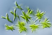 Ankistrodesmus sp. green algae, LM