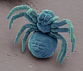 Newly hatched spiderling, SEM