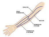 Venous cannulation sites in the arm, illustration