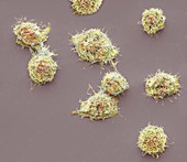 Lymphoma cancer cells, SEM