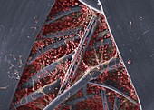 Blood clot on plaster, SEM