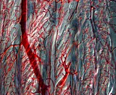 Tongue blood vessels, light micrograph