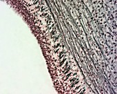 Spinal cord nerve cells, light micrograph