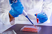 Pipetting sample