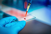 Scientist preparing microscope slide