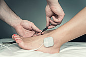 Placing TENS electrodes on foot