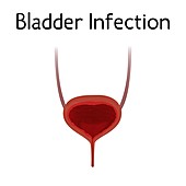 Bladder infection, illustration