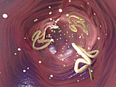 Tapeworms in human intestine, illustration