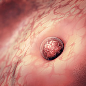 Implantation of embryo, illustration