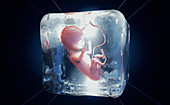 Frozen foetus, conceptual illustration