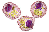 Macrophage foam cell, illustration