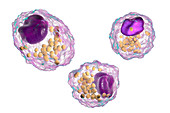 Macrophage foam cell, illustration