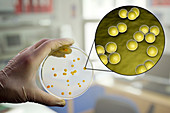 Micrococcus luteus bacteria, composite image