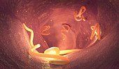 Tapeworm infestation in human intestine, illustration