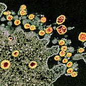 Covid-19 coronavirus, TEM