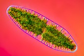 Netrium algae, light micrograph