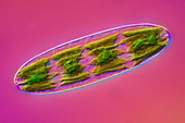 Netrium algae, light micrograph