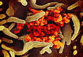 Covid-19 coronavirus particles, SEM